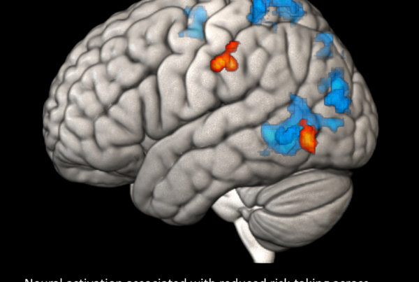 Photo of a brain scan