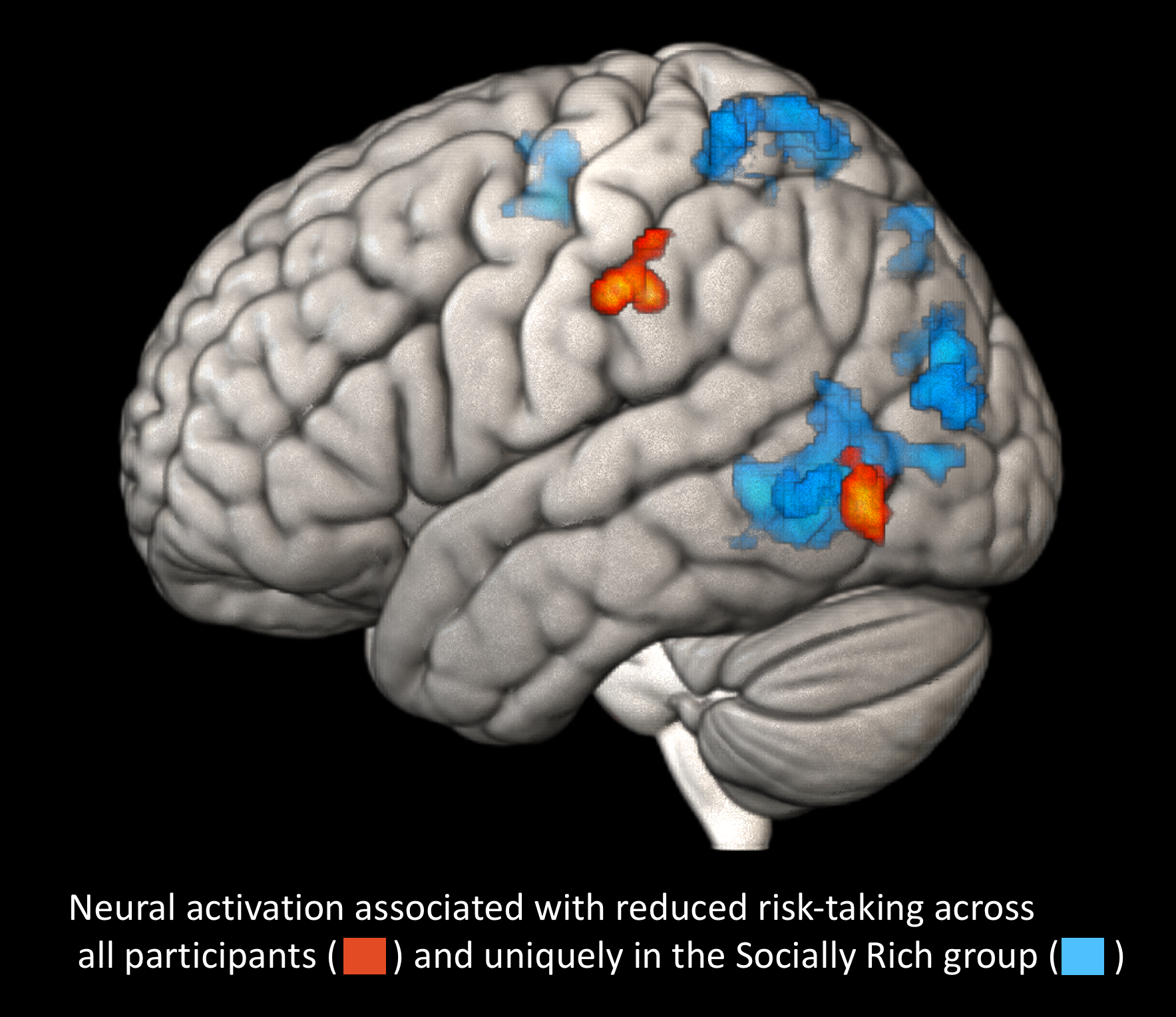 The way you grew up may shape how your brain handles risk
